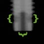 Radiograph showing apical chamber, outlined in green