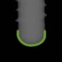 Radiograph showing curved, outlined in green