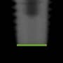 Radiograph showing flat, outlined in green