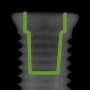 Radiograph showing internal, outlined in green