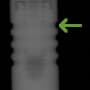 Radiograph showing midbody grooves, outlined in green