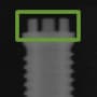 Radiograph showing unique, outlined in green