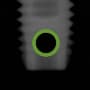 Radiograph showing round hole, outlined in green