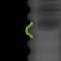 Radiograph showing rounded, outlined in green