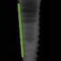 Radiograph showing tapered, outlined in green
