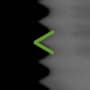 Radiograph showing v-shaped, outlined in green