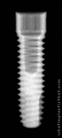 Radiograph of Implus Cylinder