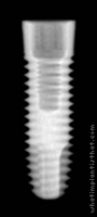 Radiograph of Implus Cylinder