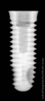Radiograph of Implus Cylinder