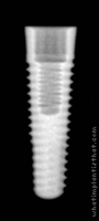 Radiograph of Tapered