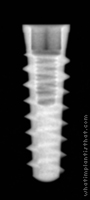Radiograph of Tapered