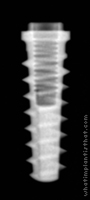 Radiograph of Tapered