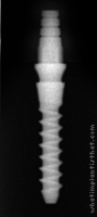 Radiograph of Nano 3