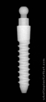 Radiograph of Nano OVD