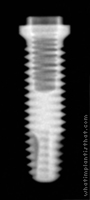 Radiograph of Implus Cylinder