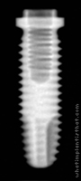 Radiograph of Implus Cylinder