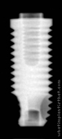 Radiograph of Implus Cylinder