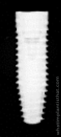 Radiograph of Bone Level Tapered RC