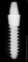 Radiograph of One-Piece Fix-Type