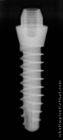 Radiograph of S-Type TM Mono Phase 2.5mm Neck