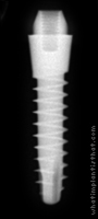 Radiograph of S-Type Transmucous Mono Phase 4mm Neck