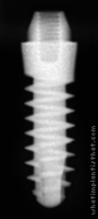 Radiograph of S-Type Transmucous Mono Phase 2.5mm Neck