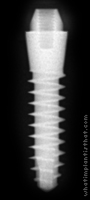 Radiograph of S-Type Transmucous Mono Phase 4mm Neck