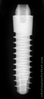 Radiograph of S-Type Transmucous Mono Phase 4mm Neck