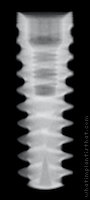 Radiograph of Dynamic