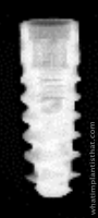 Radiograph of BLX Roxolid RB