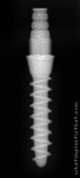 Radiograph of Tixos Nano 2