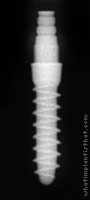 Radiograph of Tixos Nano 2