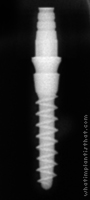 Radiograph of Tixos Nano 3