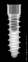 Radiograph of Tixos