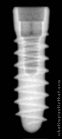 Radiograph of Tixos MC