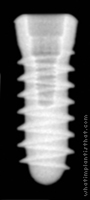 Radiograph of Tixos MC