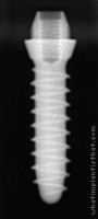 Radiograph of Tixos S-Type 1.8mm Neck