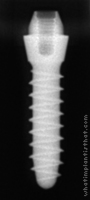 Radiograph of Tixos S-Type 2.8mm Neck
