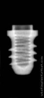 Radiograph of Tixos Short