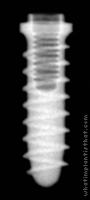 Radiograph of Tixos