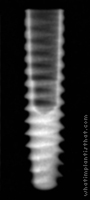 Radiograph of Axiom 2.8