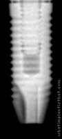 Radiograph of Anthofit HE Straight