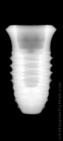 Radiograph of INNO Internal