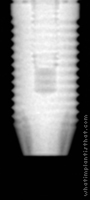 Radiograph of Anthofit HE Straight