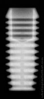 Radiograph of P Form