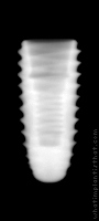 Radiograph of INNO Submerged