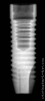 Radiograph of Anthofit OI Straight
