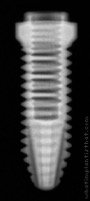 Radiograph of Osseous Standard