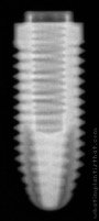 Radiograph of Osseous Standard