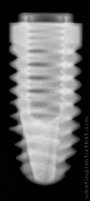 Radiograph of Osseous Maxi